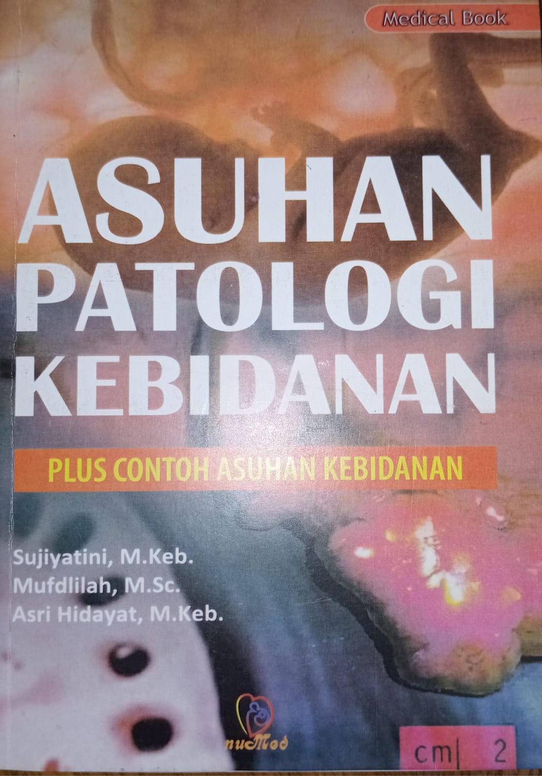 ASUHAN PATOLOGI KEBIDANAN PLUS CONTOH ASUHAN KEBIDANAN